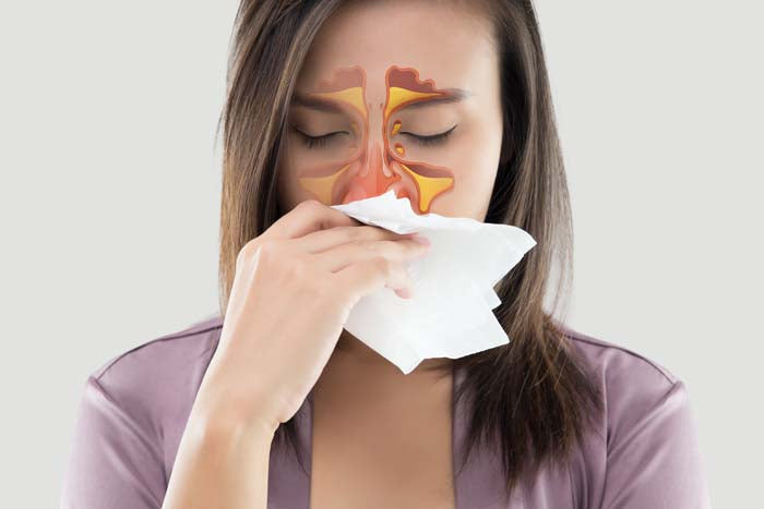 Sinus Infections and Your Sinuses - The Basics