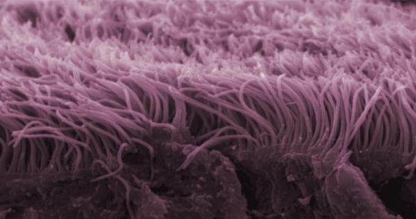 Cilia in Sinuses